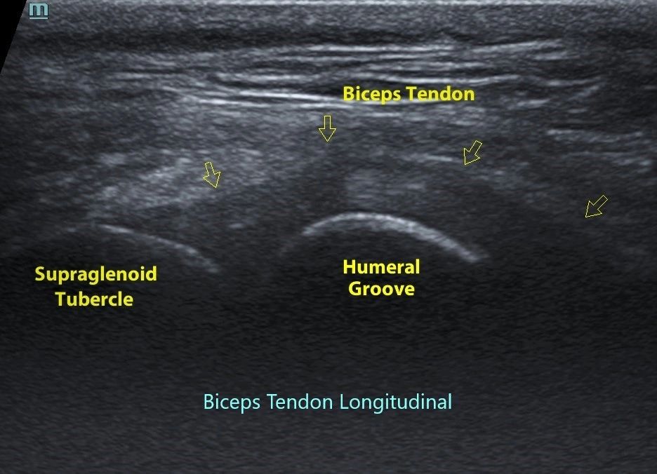 Musculoskeletal Ultrasound